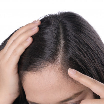 Everything you need to know about dandruff.