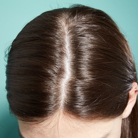3 signs your scalp us unhealthy.